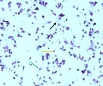 A closeup image of purple cells against a blue background with various arrows pointing to different features.